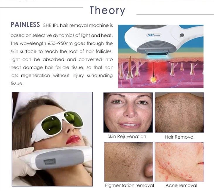 Multifunction Ipl Elight Ipl Super Hair Removal Laser Machine