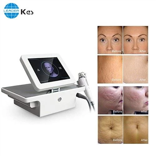 Rf Microneedle Rf Microneedling Màquina Saló Ús portàtil fraccional Rf Estiramiento facial Microneedle Equip